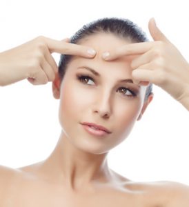 Acne Natural Treatments